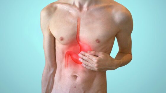 stomachache, acid reflux, gastritis