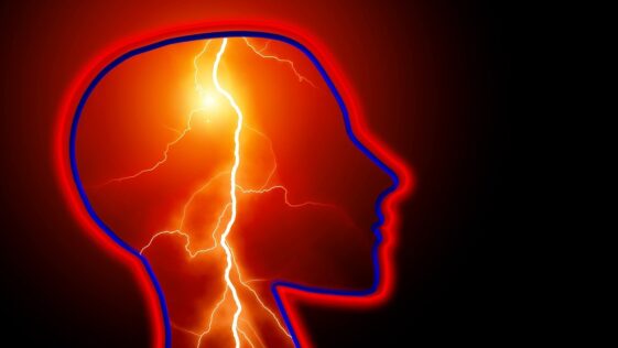 epilepsy, seizure, stroke