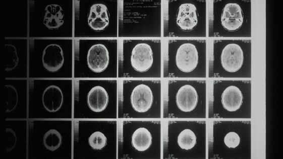 a black and white photo of various mri images