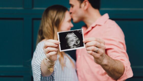 man kissing woman's forehead white holding ultrasound photo
